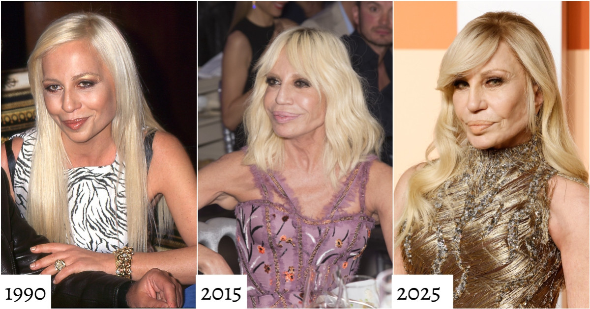 Így nézett ki Donatella Versace a plasztikai műtétek előtt