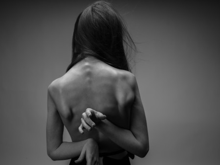 Borítókép: Amikor a mérleg már csak 28 kilót mutatott: egy (majdnem) hétköznapi lány nem hétköznapi küzdelme magával – és a világgal