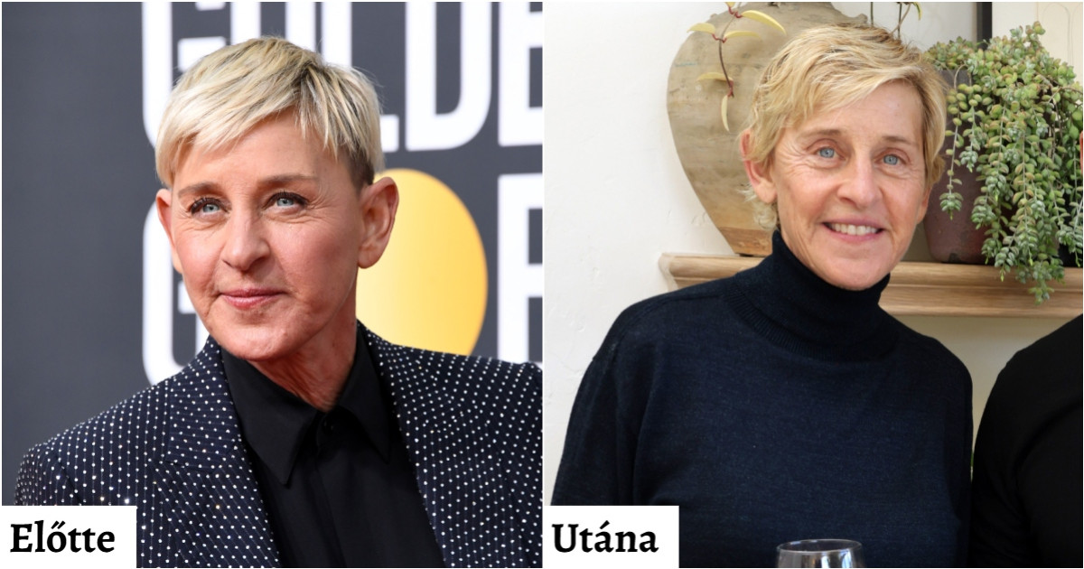 Sztárok, akik kivetették arcukból a fillereket - Teljesen máshogy néznek ki természetes külsővel