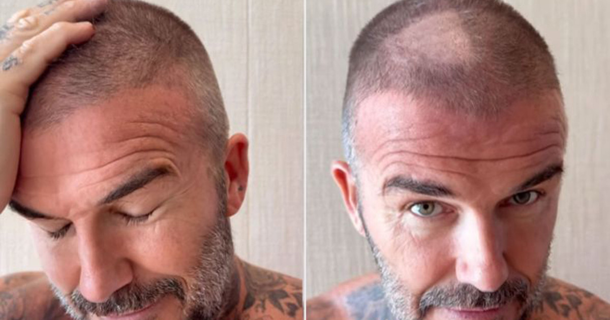 David Beckham új frizurája