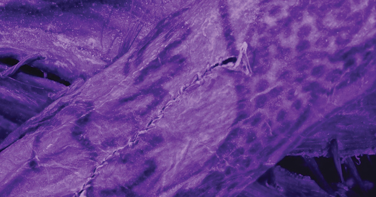 Alaposan ki volt varrva a 2500 éves szibériai jégmúmia