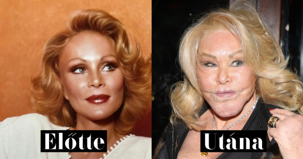 Borítókép: 7 sztár, akit teljesen eltorzított a plasztika! Ők az élő bizonyítékok, hogy a kevesebb néha több - akkor és most fotók!