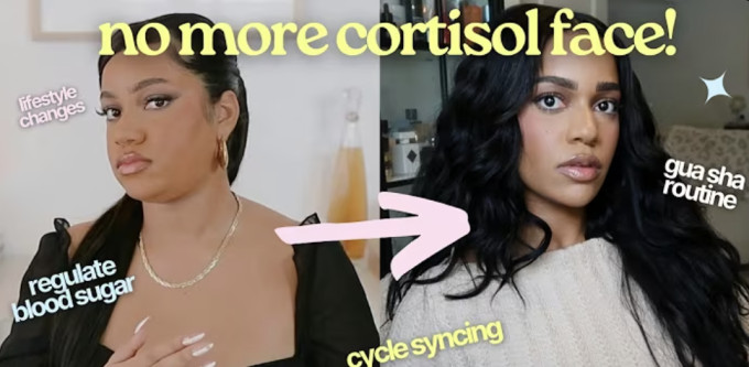 A fotón jól látható, hogy milyen szembetűnő a „cortisol face” jelensége.