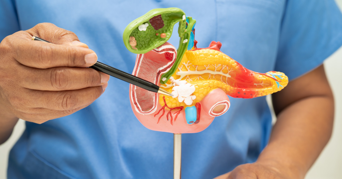 Egy orvos tollal mutogat a hasnyálmirigy modelljén.