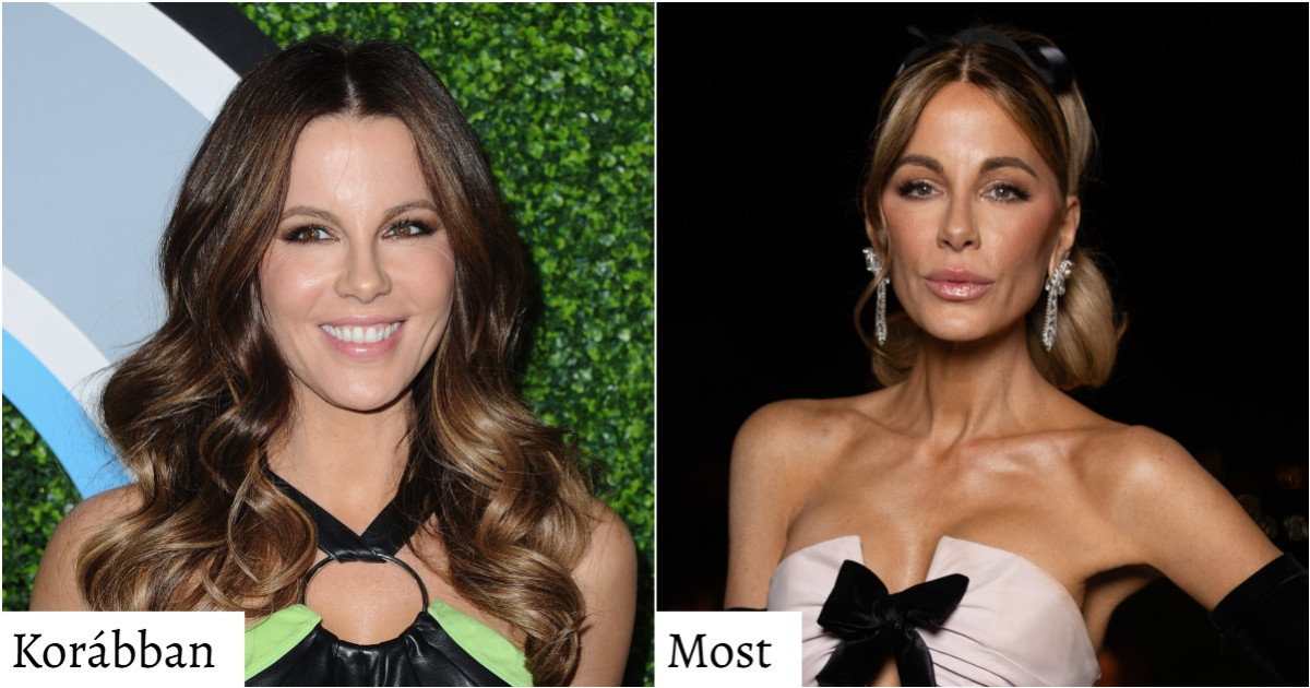 7 sztár, aki teljesen máshogy néz ki ma már a plasztika miatt