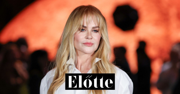 Borítókép: Ez tényleg Nicole Kidman? A rajongók szerint felismerhetetlen új fotóin a színésznő