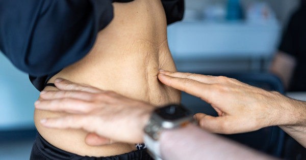 Borítókép: Alakkorrekció szülés és nagyobb fogyás után